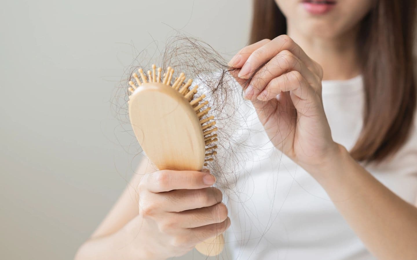 Hair Loss, skin concern treated at Kaiteki Skin Aesthetic Clinic