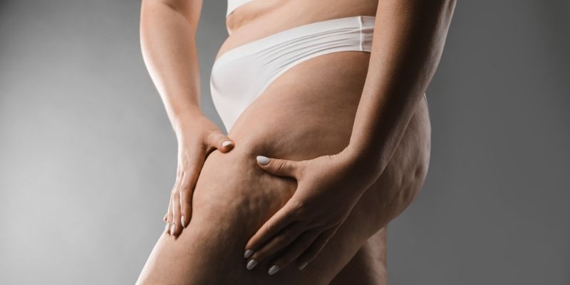 Cellulite Smoothing