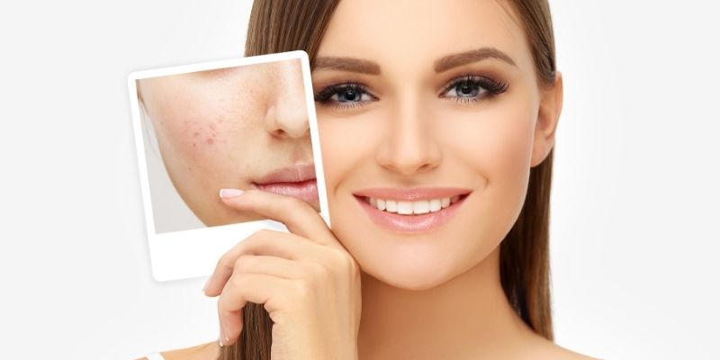 Safe for All Skin Types