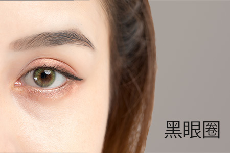 Dark Eye Circle